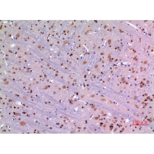 MANF / ARMET Antibody (1-50 aa, Internal)