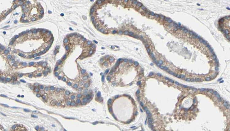 TCHP Antibody