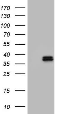 OTC Antibody (aa33-354, clone OTI2G6, Carrier-free)
