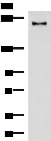 KIF21B Antibody