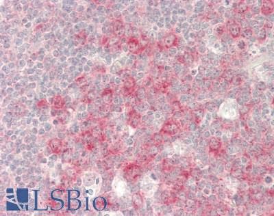 Polyclonal Rabbit anti-Human DNAM-1 / CD226 Antibody (aa225-274, IHC, WB)