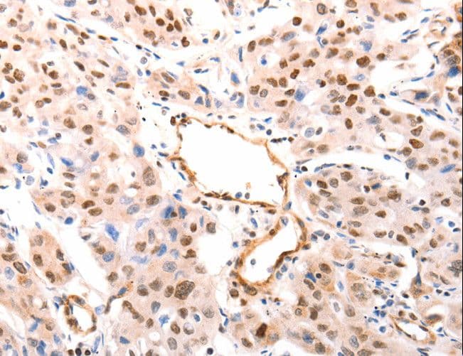 CASP9 / Caspase 9 Antibody