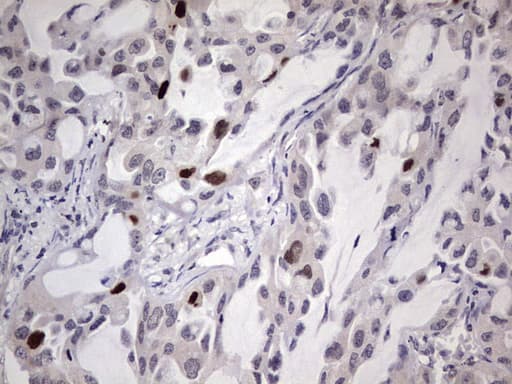 MDM2 Antibody (aa119-438, clone OTI22D6, Carrier-free)