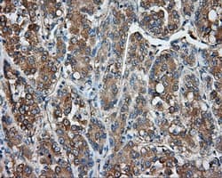 PRKAR2A Antibody (clone OTI4A3)