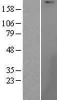 UBR1 Protein (Over-Expression Lysate Myc-DDK (Flag))