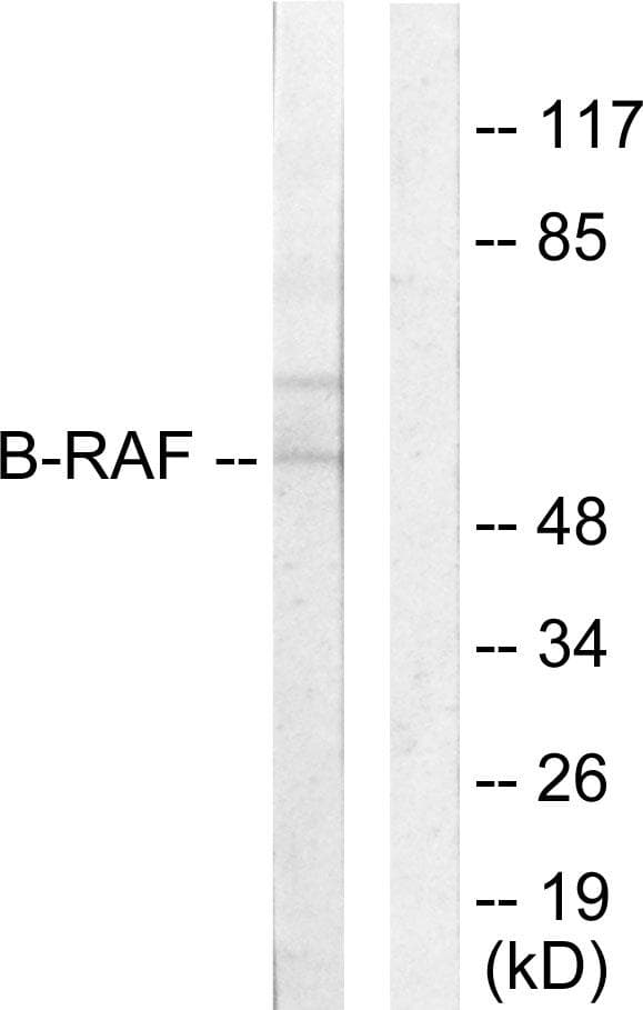 Polyclonal Rabbit anti-Human BRAF / B-Raf Antibody (IHC, IF, WB)