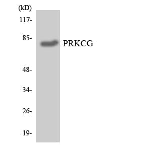 Polyclonal Rabbit anti-Human PRKCG / PKC-Gamma Antibody (aa165-214, WB)