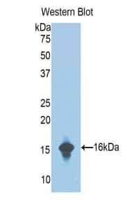 CFB / Complement Factor B Antibody (aa476-592, APC, Cy7)