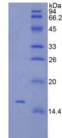 Rat TSLP Protein (Recombinant His, N-Terminal)