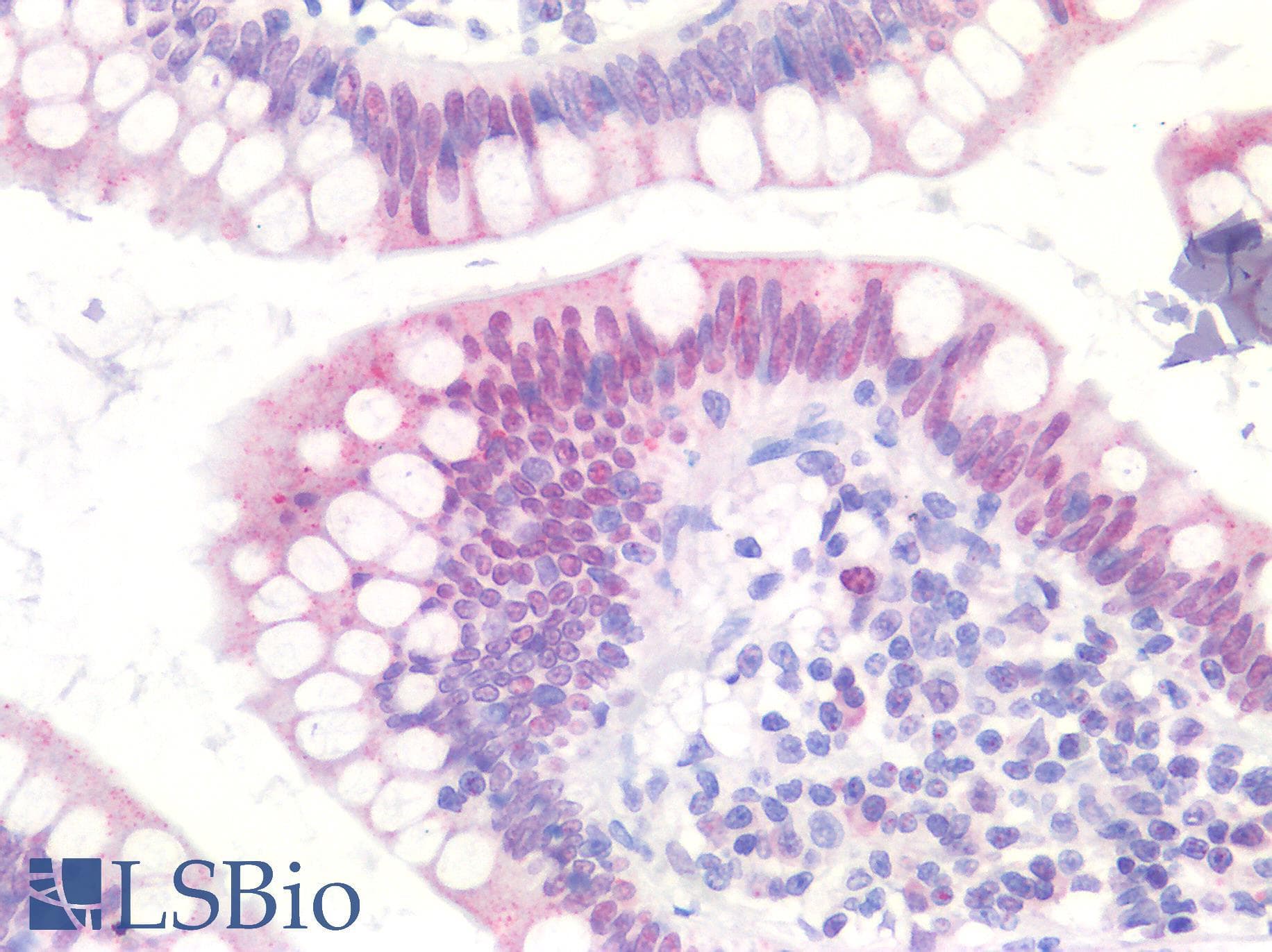 IHC-plus™ Polyclonal Rabbit anti-Human MKI67 / Ki67 Antibody (IHC)