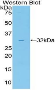 MAPK11 / SAPK2 / p38 Beta Antibody (aa38-277)