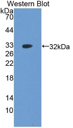 MAP3K5 / ASK1 Antibody (aa681-936, Cy3)