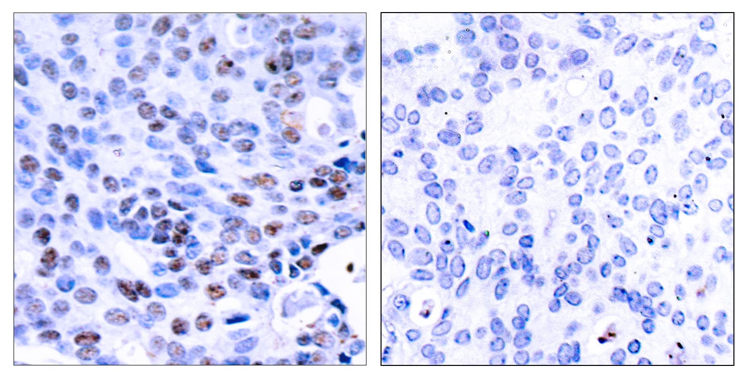 NFKB1 / NF-Kappa-B Antibody (aa304-353)