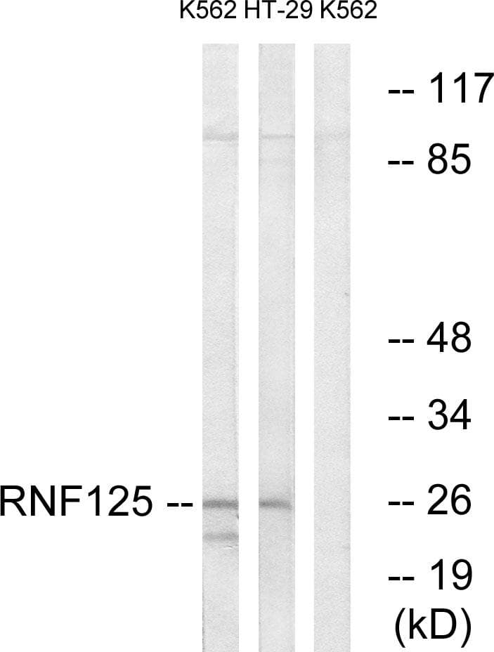 RNF125 / TRAC-1 Antibody