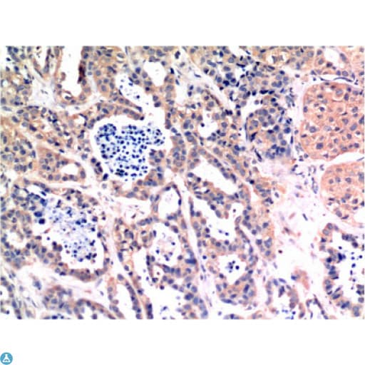 Monoclonal Mouse anti-Human BAX Antibody (IHC, WB)