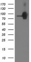 CTNNB1 / Beta Catenin Antibody (clone OTI1B11)