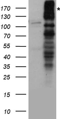 Polyclonal Rabbit anti-Human GRIN2A / NMDAR2A / NR2A Antibody (WB)