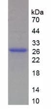 Human MYH1 Protein (Recombinant His-T7)
