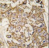 Polyclonal Rabbit anti-Human ERBB2 / HER2 Antibody (aa21-52, IHC, WB)