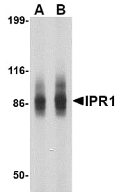 Polyclonal Rabbit anti-Human SP110 Antibody (WB)