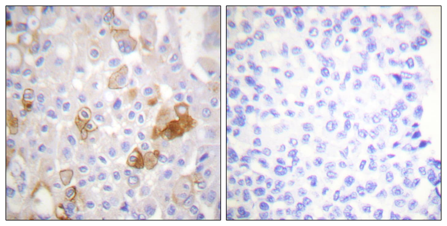 ITGB1 / Integrin Beta 1 / CD29 Antibody (phospho-Thr788)
