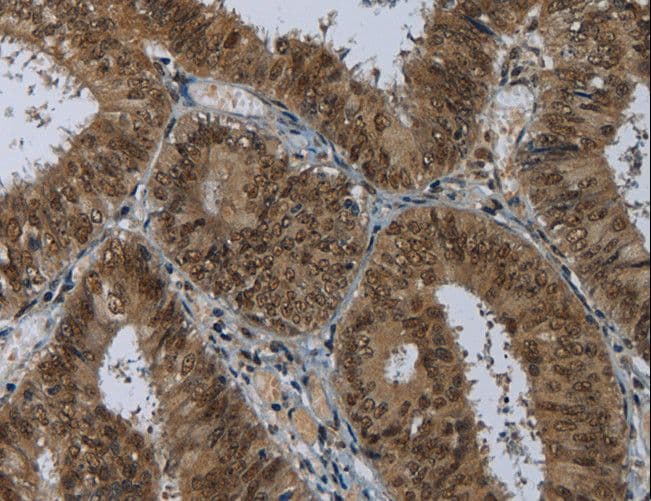MRE11A / MRE11 Antibody