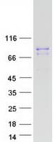 Human GFM2 Protein (Recombinant Myc-DDK (Flag))