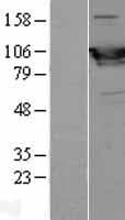 Human PYGM Protein (Over-Expression Lysate Myc-DDK (Flag))