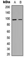 ACAN / Aggrecan Antibody (N-Terminus)