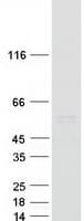 Human CCNA1 / Cyclin A1 Protein (Recombinant Myc-DDK (Flag))