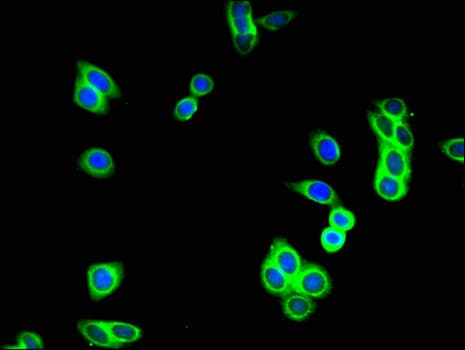 GUCY2C / Guanylyl Cyclase C Antibody