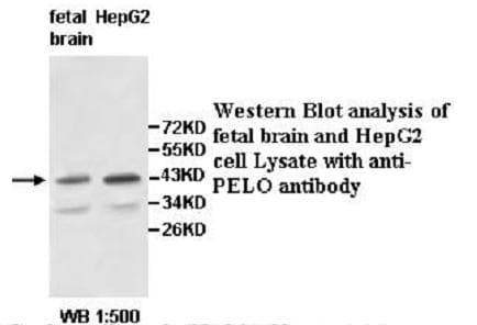 Polyclonal Rabbit anti-Human PELO Antibody (aa71-333, IHC, WB)