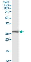 Monoclonal Mouse anti-Human NKX3-1 Antibody (clone 3H6, WB)