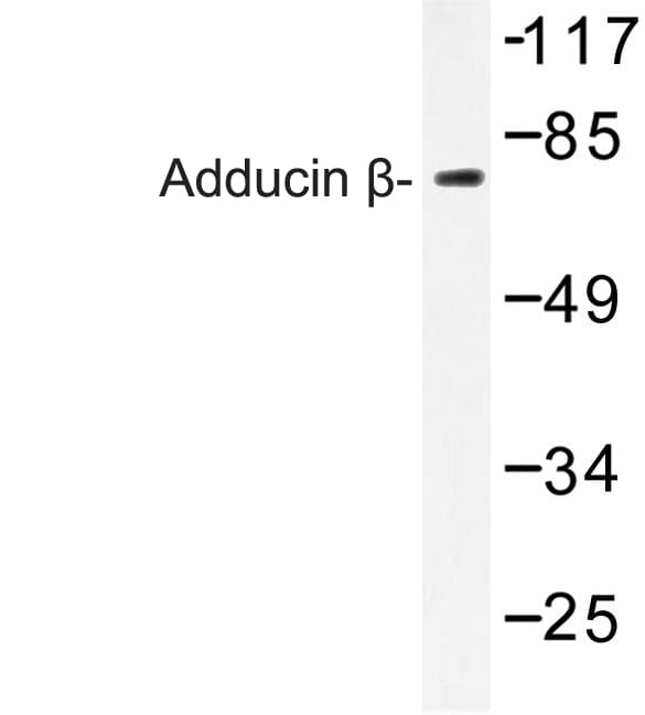 Polyclonal Rabbit anti-Human ADD2 Antibody (Glu497, IF, WB)