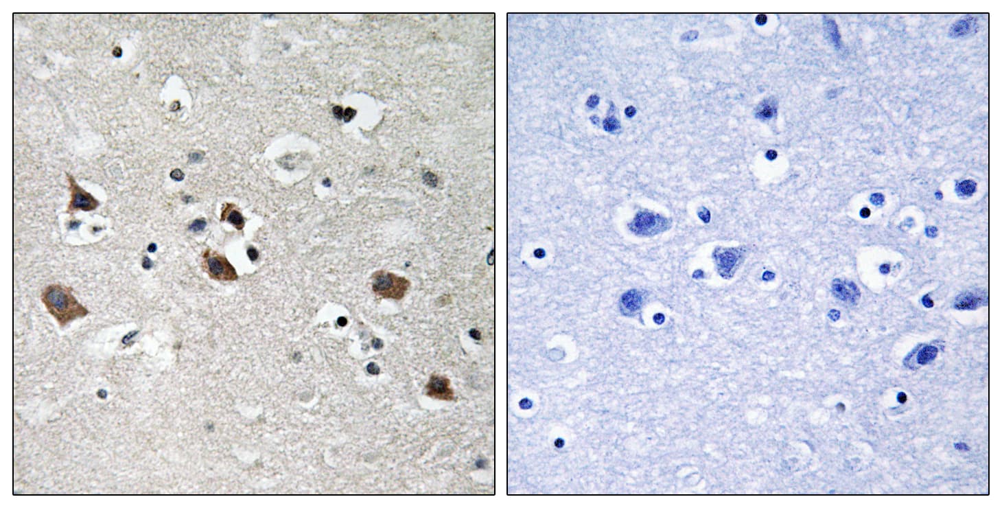 LCP2 / SLP-76 Antibody (phospho-Tyr128)