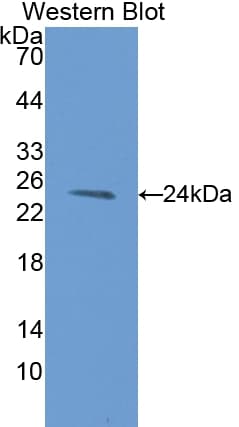 AGR2 Antibody (aa21-175, HRP)