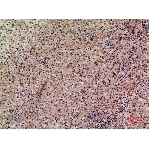 XCL1 / Lymphotactin Antibody (51-100 aa, Internal)