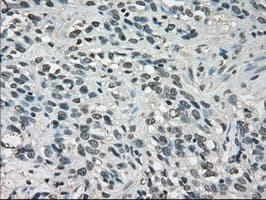 Monoclonal Mouse anti-Human LDHA / LDH1 Antibody (clone OTI2D11, IHC, WB)