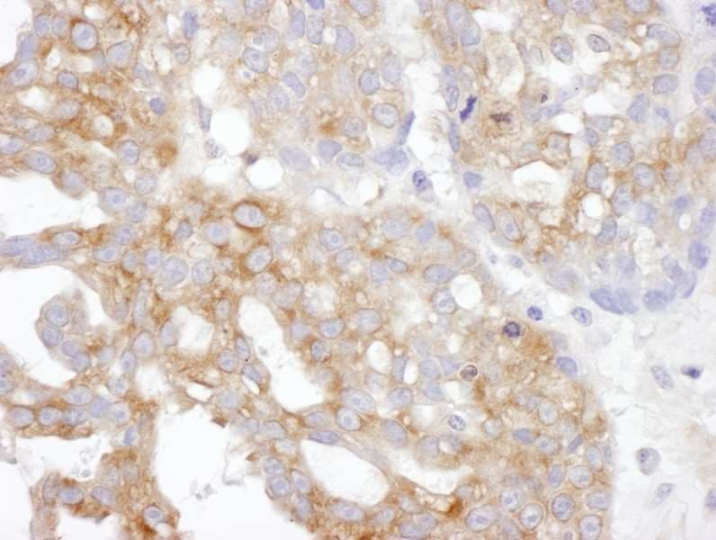 TXLNA / Alpha Taxilin Antibody (aa496-546)