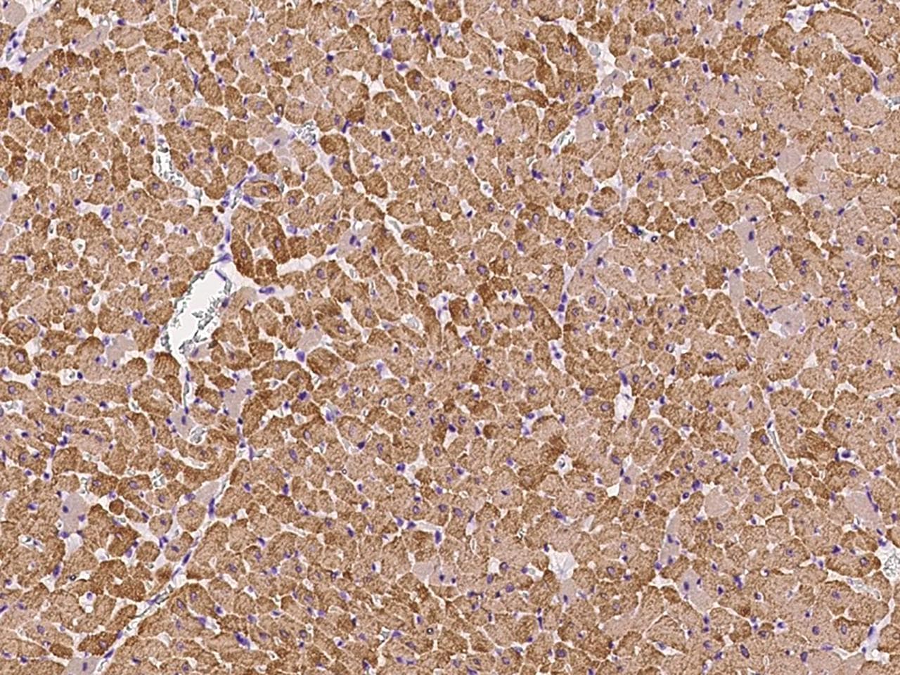 Polyclonal Rabbit anti-Mouse MYL2 Antibody (IHC, WB)