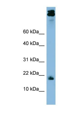 ASAH1 / Acid Ceramidase Antibody (aa287-336)