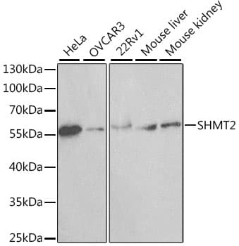IHC-plus™ SHMT / SHMT2 Antibody