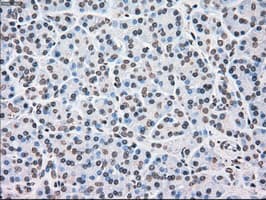 CHEK2 / CHK2 Antibody (clone OTI4C10)