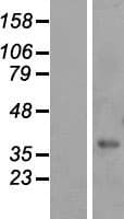 FAM98C Protein (Over-Expression Lysate Myc-DDK (Flag))