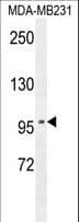 Polyclonal Rabbit anti-Human ST7 Antibody (aa169-197, WB)