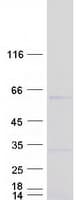 Human ZNF385B / ZNF533 Protein (Recombinant Myc-DDK (Flag))