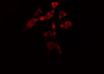 CYP1B1 Antibody