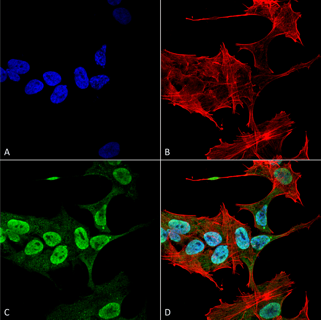 SNCA / Alpha-Synuclein Antibody (clone 3C11, RPE)