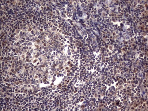 Monoclonal Mouse anti-Human C14orf166 Antibody (clone OTI2C3, IHC, WB)