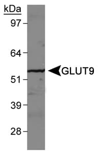 SLC2A9 / GLUT9 Antibody (Internal, Biotin)